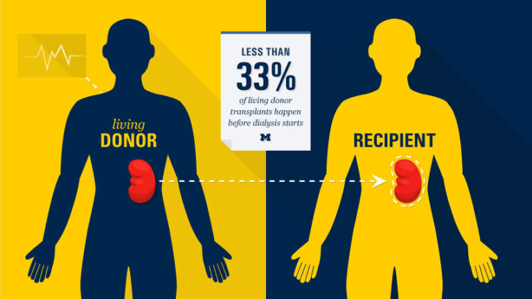 Kidney transplant